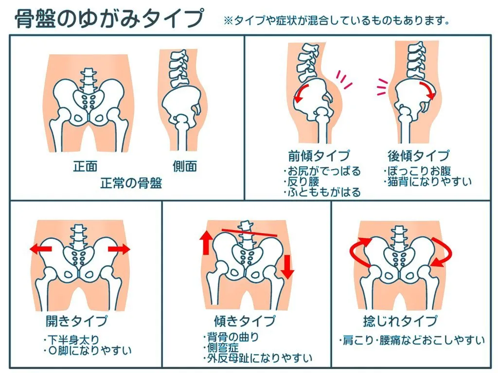 骨盤の調整はお任せくださいませ